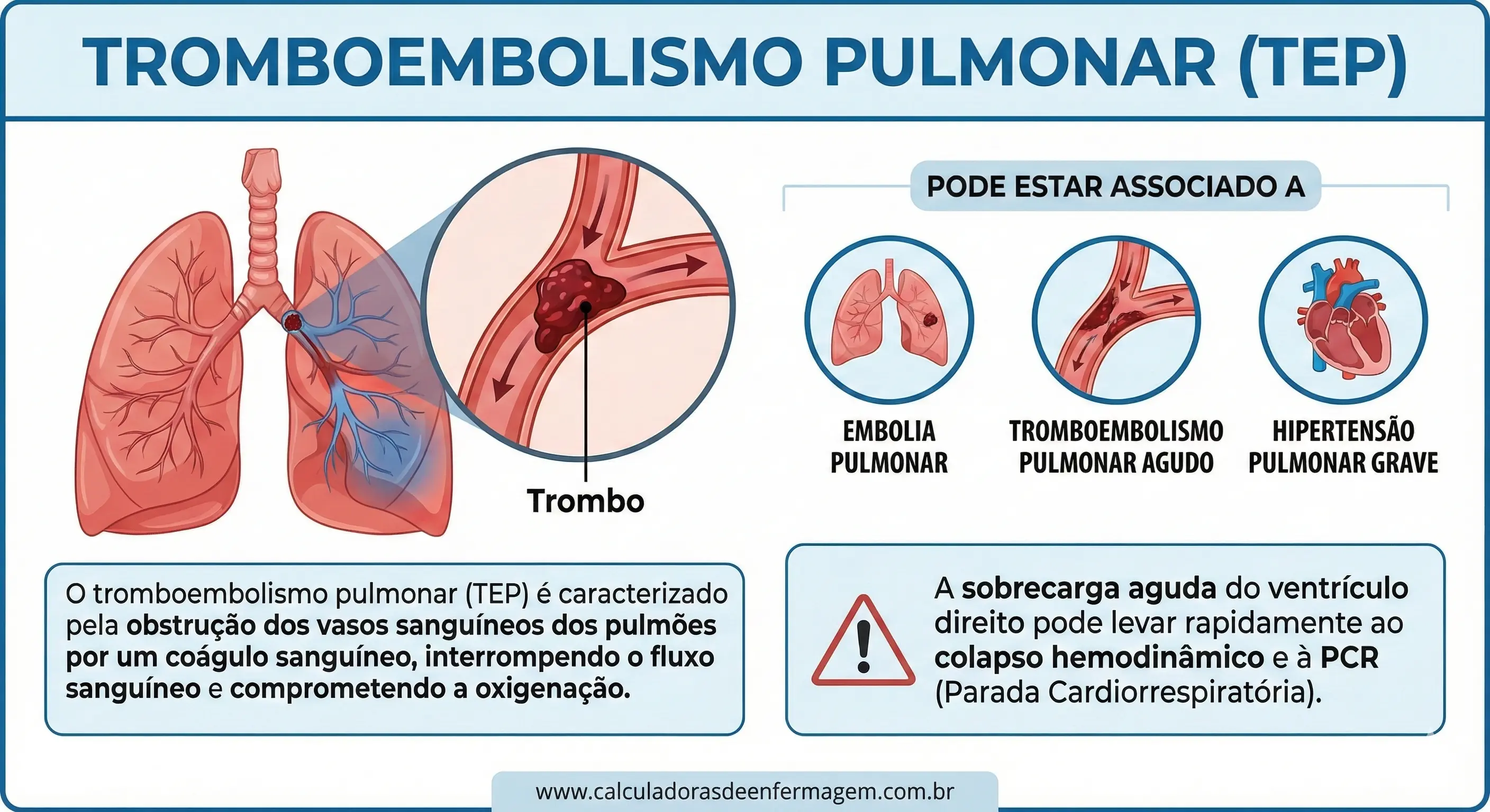 5ts Tromboembolismo Pulmonar